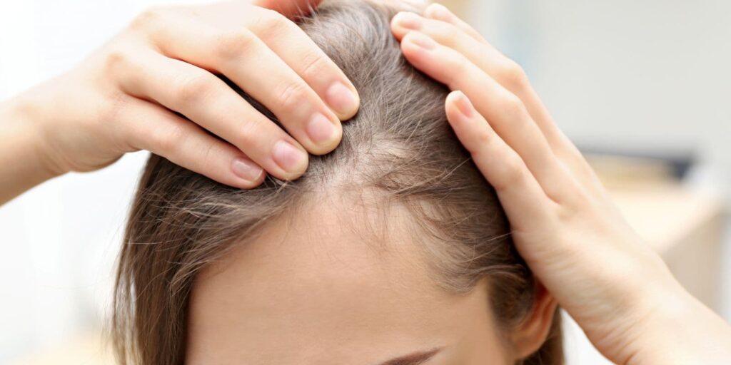 Por qué se cae el pelo