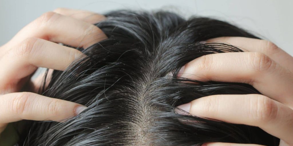 cabello graso