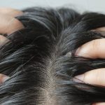 cabello graso detalle