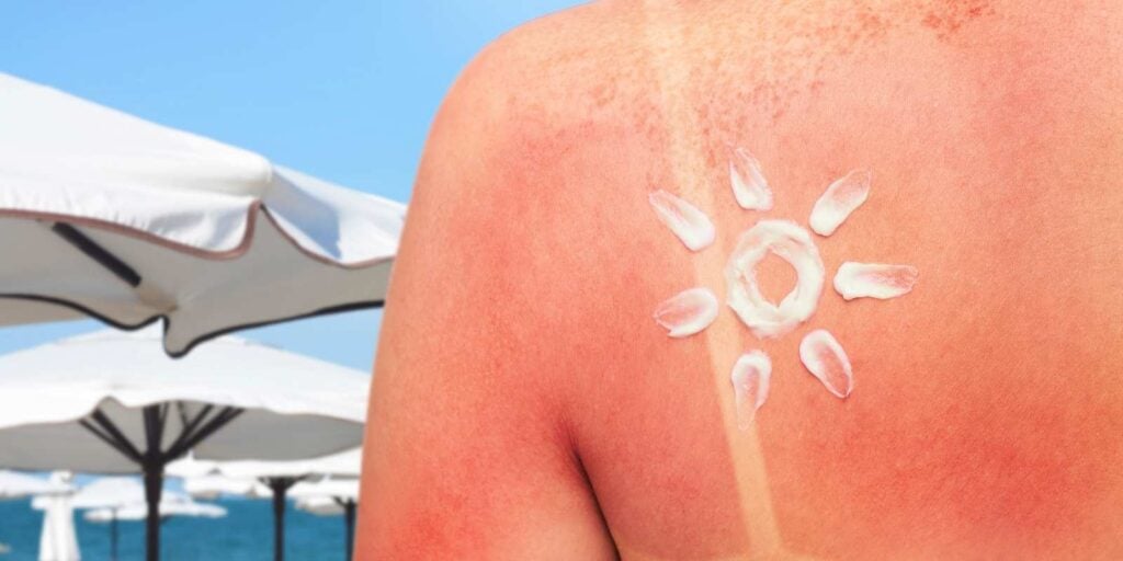 crema solar proteccion solar pieles sensible