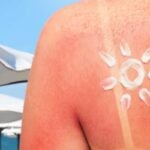 crema solar proteccion solar pieles sensible