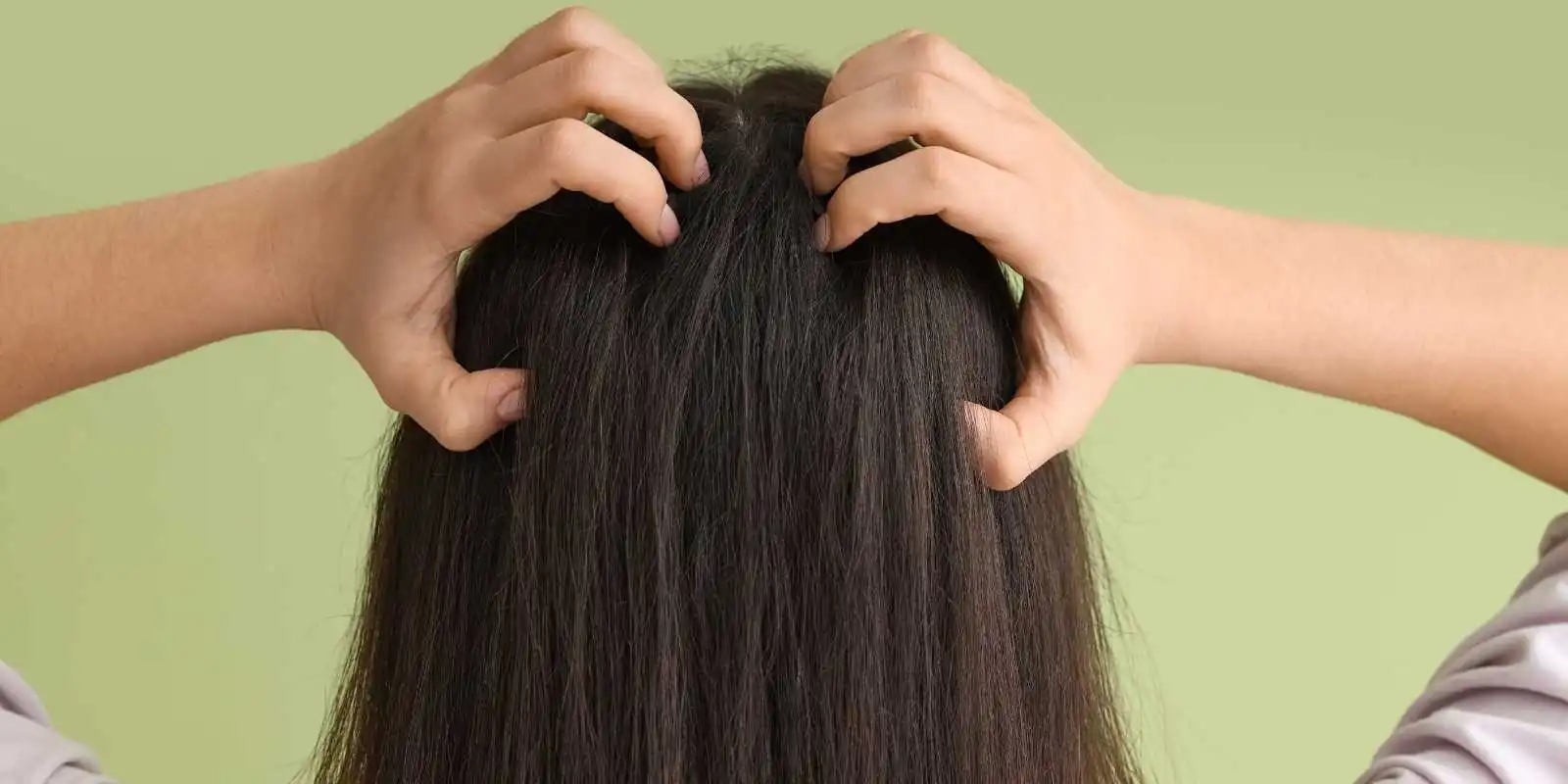 me pica mucho la cabeza